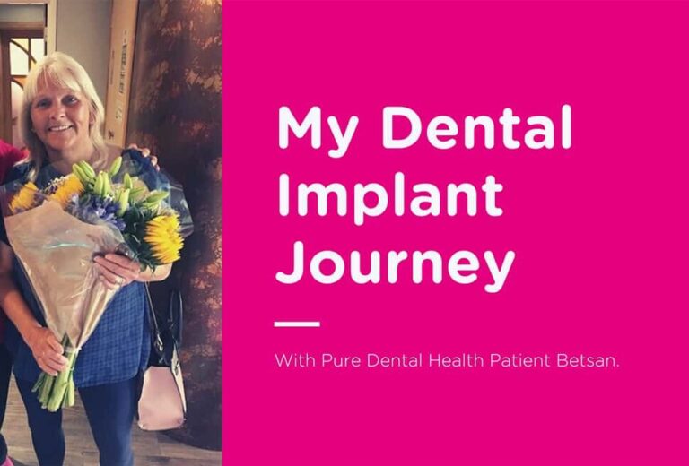Dental patients Dental Implant Journey