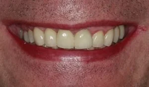 Mr B Smile After