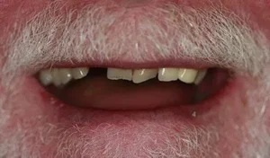 Mr P Smile Before