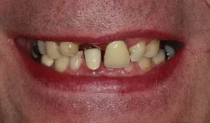Mr B Smile Before
