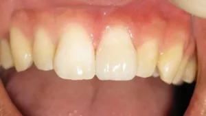 Mr S Smile After