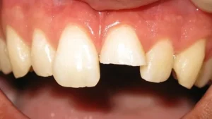 Mr S Smile Before