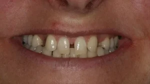 Mrs 2 Smile Before