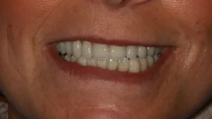 Mrs A Smile After
