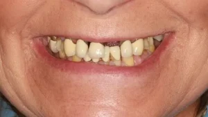 Mrs A Smile Before