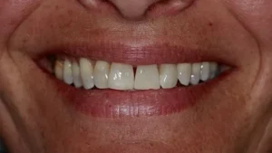 Mrs B Smile After