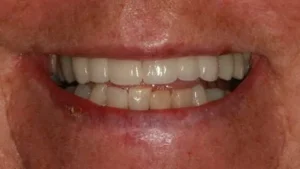 Mrs B Smile After