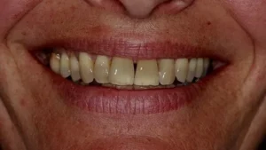 Mrs B Smile Before