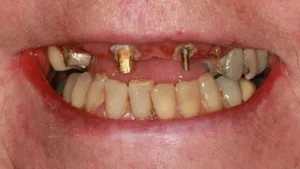 Mrs B Smile Before