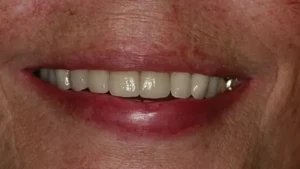 Mrs C Smile After