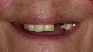 Mrs C Smile Before
