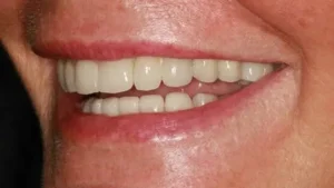 Mrs D Smile After