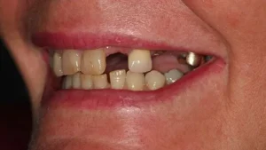 Mrs D Smile Before