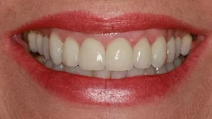 Mrs K Smile After