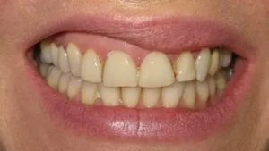 Mrs K Smile Before