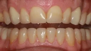 Mrs L Smile After