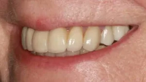 Mrs M Smile After