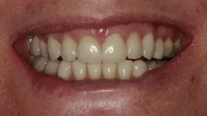 Mrs M Smile After