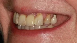 Mrs M Smile Before
