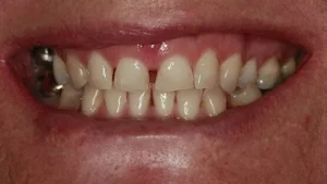 Mrs M Smile Before
