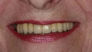 Mrs P Smile After