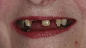 Mrs P Smile Before