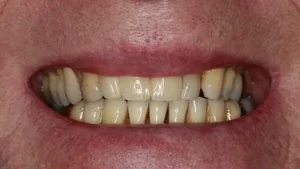 Mrs S Smile After