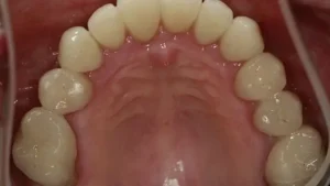 Mrs S Smile After