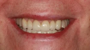 Mrs S Smile After