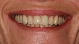 Mrs S Smile After