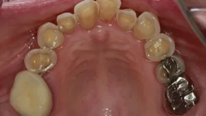 Mrs S Smile Before