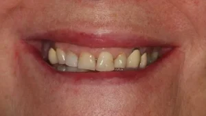 Mrs S Smile Before