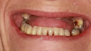 Mrs S Smile Before