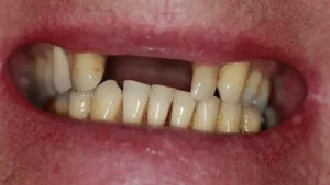 Mrs S Smile Before