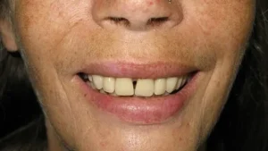 Mrs T Smile After