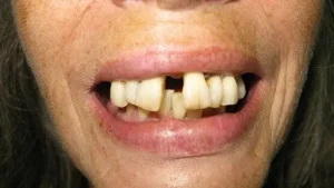 Mrs T Smile Before