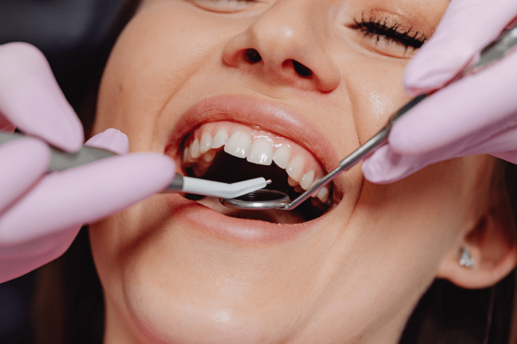 Periodontal Surgery What To Expect