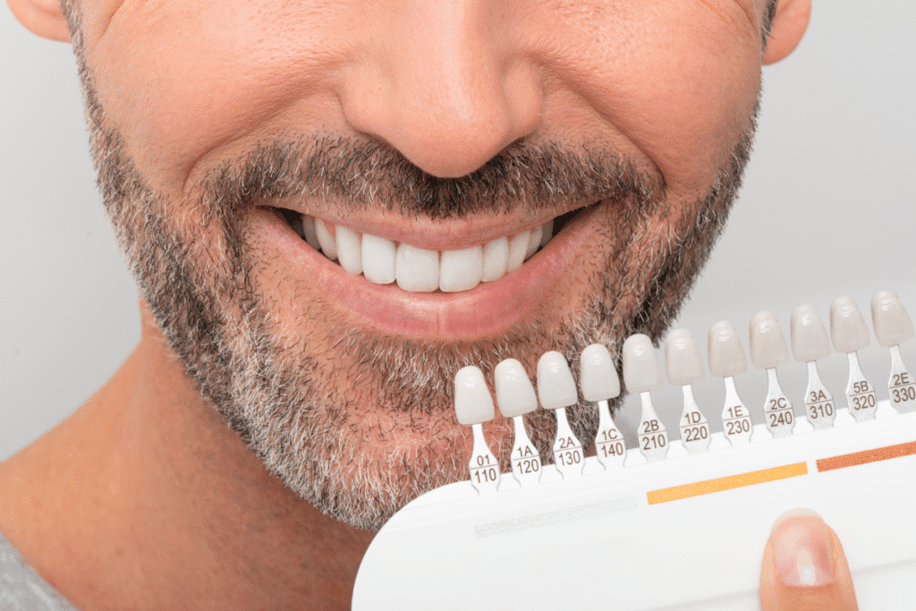 Different Types Of Dental Implants For Perfect Smile