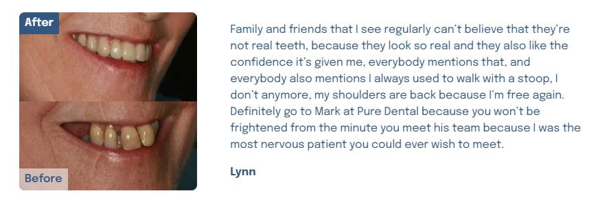 Overcome Dental Phobia And Anxiety With Gentle Expert Care  