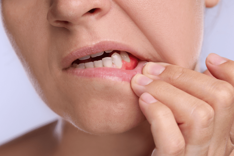 Tooth Abscess Stages Your Complete Guide
