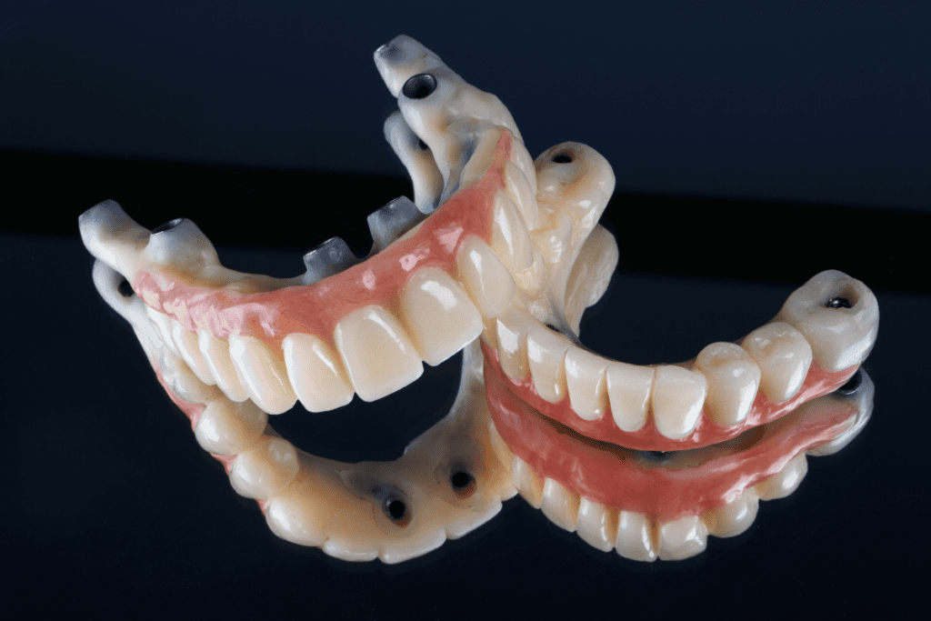 Dental Implants Vs Dentures Which Should I Choose