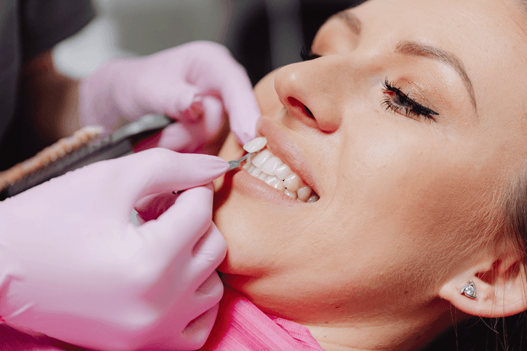Porcelain Veneers Vs Composite Bonding